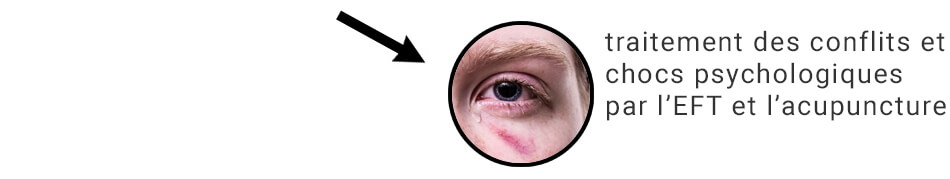 traitement des conflits et chocs psychologique par l'EFT et acupuncture
