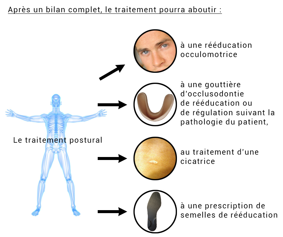 traitement postural